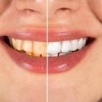 PÂTE DENTIFRICE LONGRICH AU THÉ BLANC ET ALOÈS SANS FLUOR